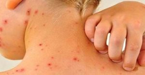 72631213_385800279035980_7040806885527650304_n_20191017121230-580x300-1