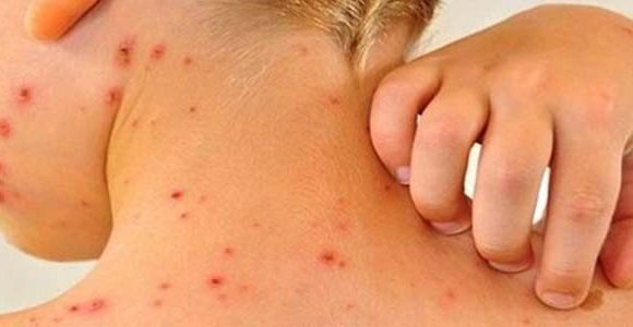 72631213_385800279035980_7040806885527650304_n_20191017121230-580x300-1