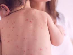 download - 2026-03-24T222355.946