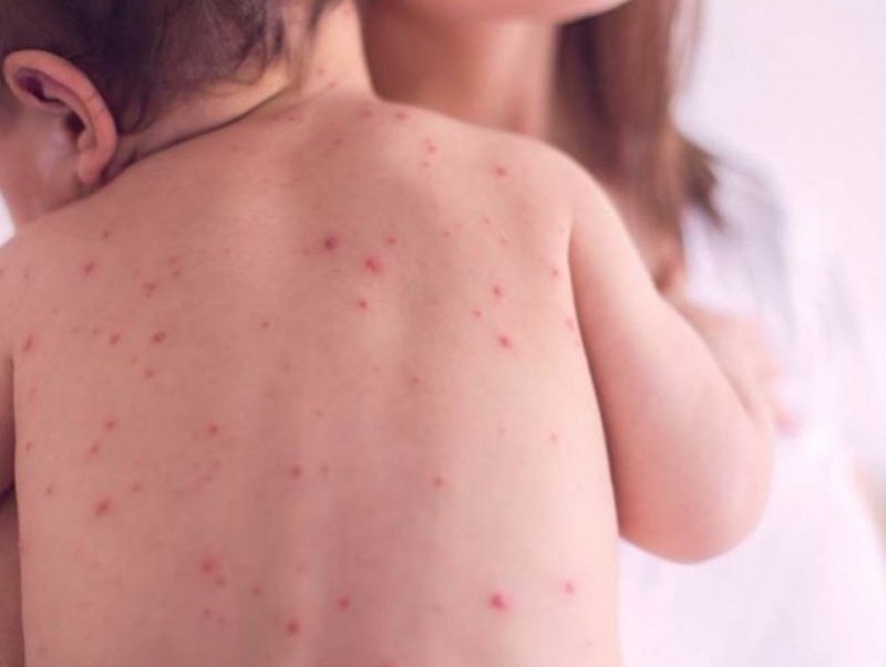 8236fa7715e51be6ed56ce8d2b56e2b6_x3