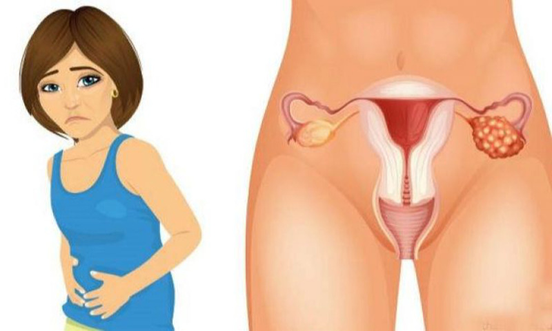 Умайн хүзүүний хорт хавдрын илрүүлэгт хөхөнцөр вирусний шинжилгээ нэвтрүүлэв